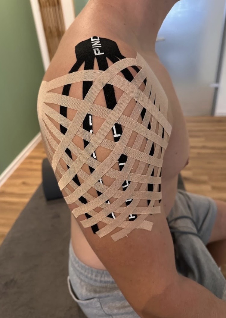 Kinesio-Taping an der Schulter aus einer Patientenbewertung
